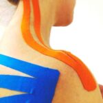TAPING-NEUROMUSCOLARE2